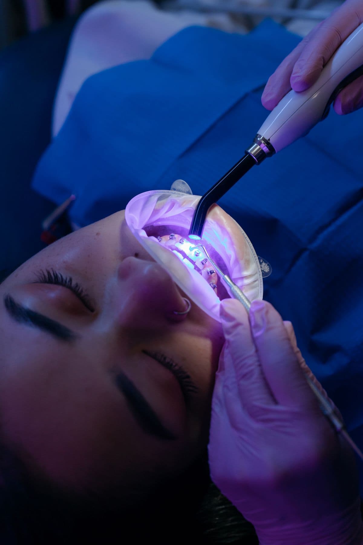 Trồng răng Implant có đau không? Thời gian hồi phục bao lâu?