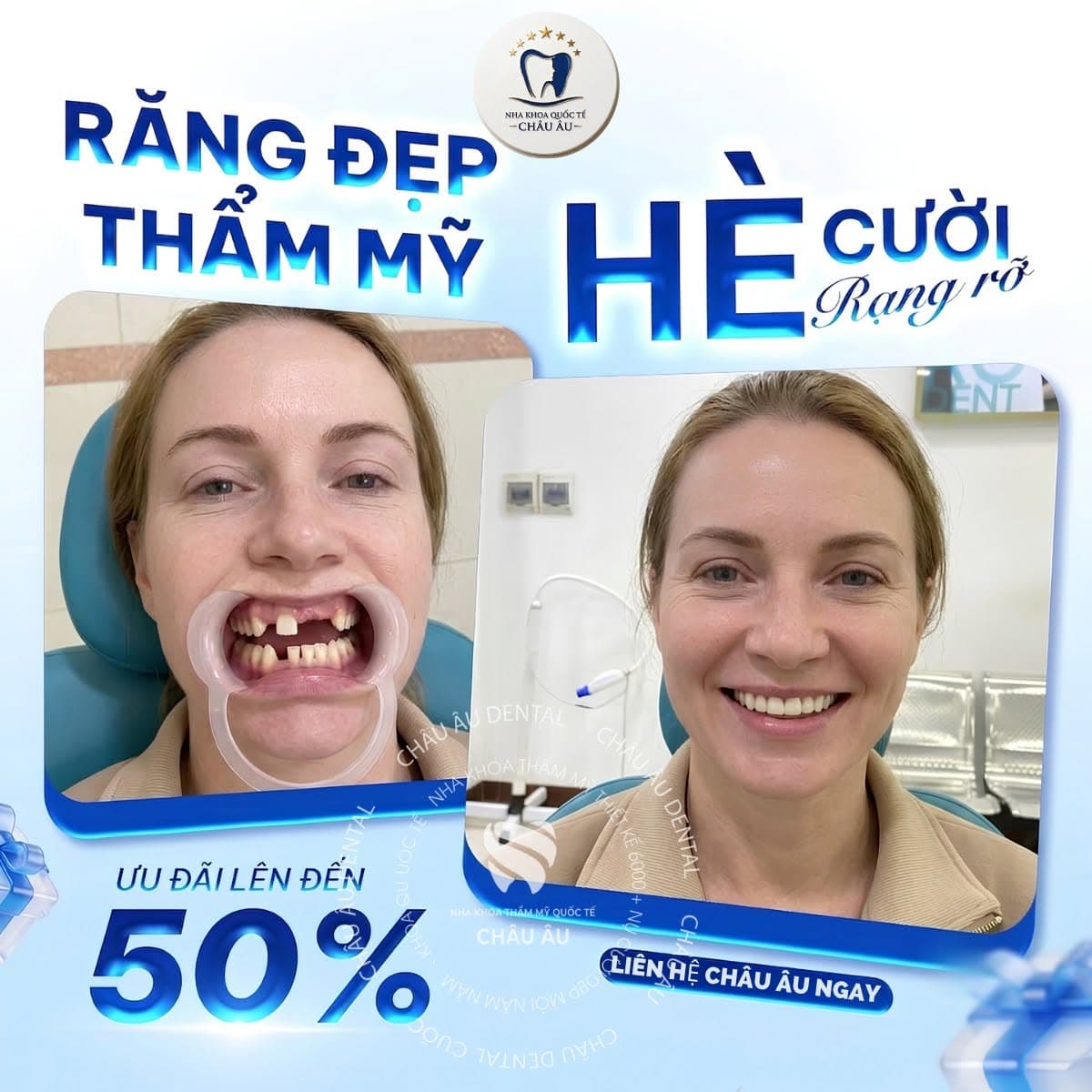 Trồng răng Implant