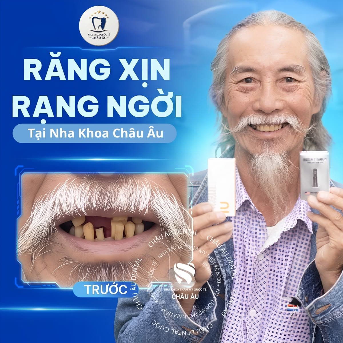 Trồng răng Implant Titanium